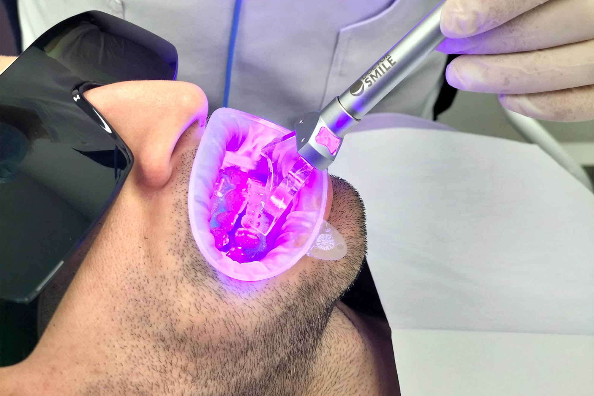  Láser de diodo dental.