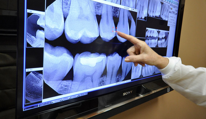 Radiografías digitales.