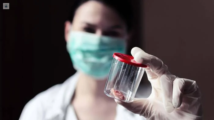 Obtención de Biopsia Intraoral